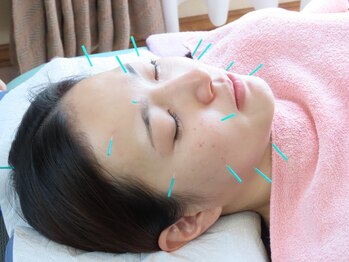 リラクゼーション 楽の写真/【美容鍼￥6500→ご新規様限定で￥4500に割引】豊富な知識と技術でお顔悩みも徹底改善◎