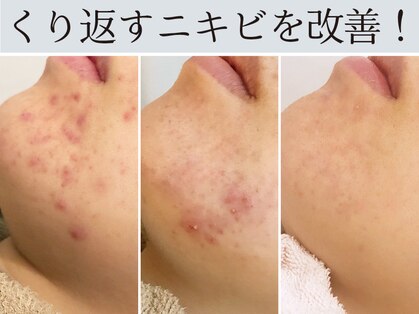 ハダイ(HADAY)の写真