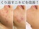 ハダイ(HADAY)の写真