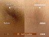 ルメラ(LEMELLA)黒ずみメラニンケア：脇/肘/膝/くるぶし