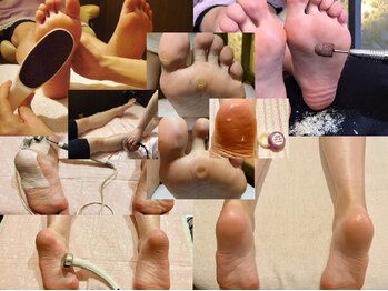 ビサンテ サロンの写真/角質ケア&特許,角質育成ケアで魚の目/タコ/足裏/ガサガサ踵,ツルプル!3D足バランス&マシン足裏,脚,全身整う