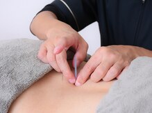 カケル鍼灸整体院(KAKERU鍼灸整体院)