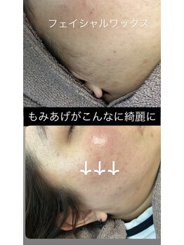 リアンダ(Rianda)/フェイシャルワックス