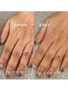 ゼロハチイチ(081)/Hand Spa Treatment