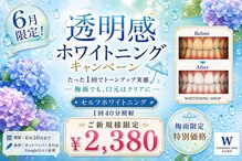 ホワイトニングショップ 名古屋店