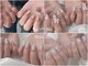 リノネイル(Rino-nail)の写真