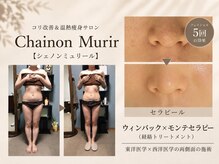 シェノンミュリール(Chainon Murir)