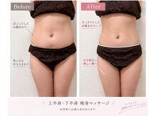 エテルナ(ETERNA)/痩身1部位集中ケア