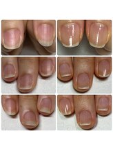 ソート(THOUGHT)/最強のネイルケアコース