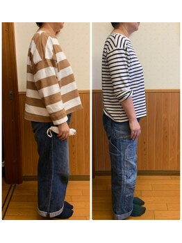 リンドール(RinDoll)/50代女性ダイエット/耳ツボ/痩身