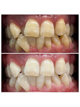 ホワイトマジック(White Magic)/症例写真