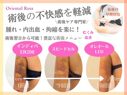 オリエンタルローザ 表参道(Oriental Rosa)の写真