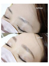 マツ(MATSU)/【ハリウッドブロウリフト】