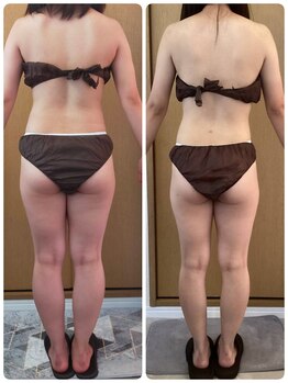 サロン エクリゼ(salon Ecrisee)/お客様ビフォーアフター