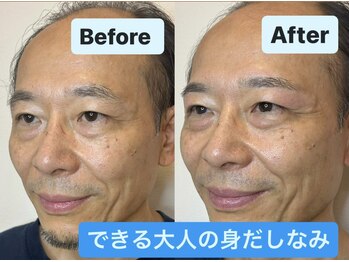 ミベレ 八王子(Mebere)/大人男性の身だしなみ