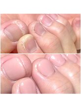 サロンネイルス(SALON NAILuz)/