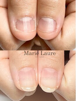 マリーロール 梅田店(Marie Laure)/深爪矯正/自爪育成/自爪風