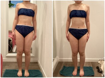 グランデヴァレ(Grande Vallee)/◆施術1回　30代