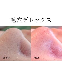 エリア(area.)/15、【毛穴デトックス】