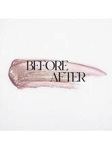 脱毛サロンnamir札幌店【ブラジリアンワックス/美容脱毛/眉毛】～メンズ/レディース～/↓before・after↓