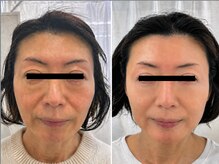 整顔院 学芸大学店/５０代　継続期間２年
