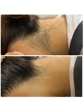 福屋。 指宿店/ちょっぴり脱毛