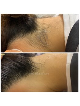 福屋。 指宿店/ちょっぴり脱毛