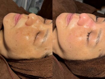 ルーナジェーナ(Luna llena)/池袋　エステ　ルーナジェーナ