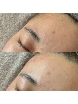 ルブール(levure)/ご相談下さい