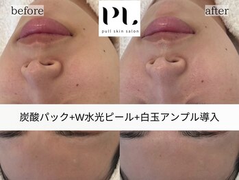 プル スキンサロン(pull skin salon)/