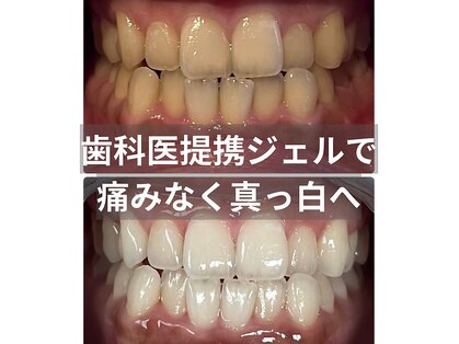 ホワイトニング ビューティー 南魚沼店(whitening beauty)の写真