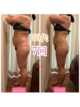 キュール(KuhL)/50代痩身ビフォーアフター☆