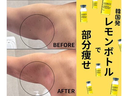 ビューティーモア 富里店(More)の写真
