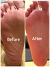 【new!!】爪福祉士による足裏ケア　その他と同時施術の場合¥5,500→¥2,980
