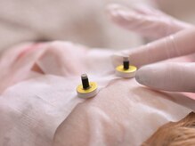 ミエリア美容鍼灸院(mielia美容鍼灸院)の雰囲気（女性の為のフェム鍼灸は「のぼせ」「不安」等も対応します。）