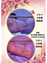 中国整体 らくらく堂/漢方深部デトックススピード痩身