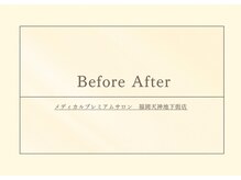 グラツィア 福岡天神地下街店/お客様のBeforeAfter［天神駅］