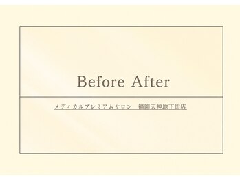 グラツィア 福岡天神地下街店/お客様のBeforeAfter［天神駅］