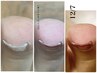 【巻き爪】フット巻き爪対応ジェル親指2本のみ(クリア)