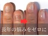 深爪を改善したい方向け【あなたに合うメニューをカウンセリングでご提案】