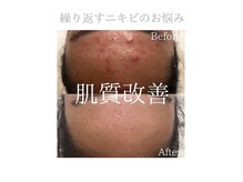 クリアビューティー(CLEAR BEAUTY)