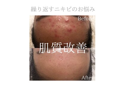 クリアビューティー(CLEAR BEAUTY)の写真