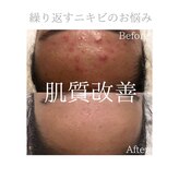 クリアビューティー(CLEAR BEAUTY)