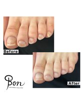 ネイルアトリエ ボン(nail atelier bon)/フットケア