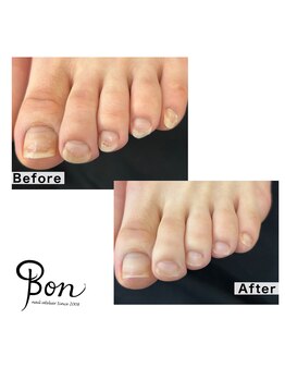 ネイルアトリエ ボン(nail atelier bon)/フットケア