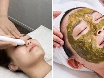 フェザード フレンズ 松山店の写真/都度払い可◎本気のニキビケア【ハーブピーリング＋毛穴ハイドロ洗浄★¥5950】毛穴に詰まったアクネ菌除去!