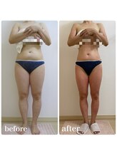 加圧ビューティーサロン スタイル エム(beauty salon style M)/40代/ピラティス×痩身120分