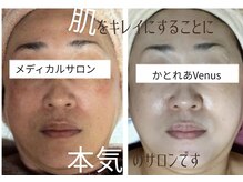 メディカルサロン かとれあ