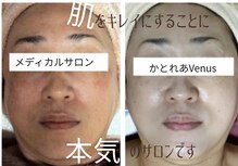 メディカルサロン かとれあ