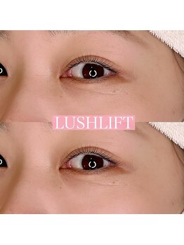 リンド エステ まつげ 京成大久保(Lind)/ラッシュリフト